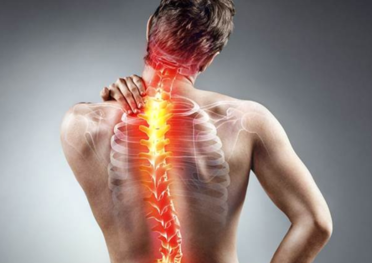 Každodenné návyky zmierňujúce bolesť chrbta
